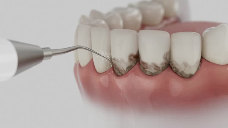Reliable Dental Implants contractor in St. Augustine Beach, FL by Smile Center Dentistry